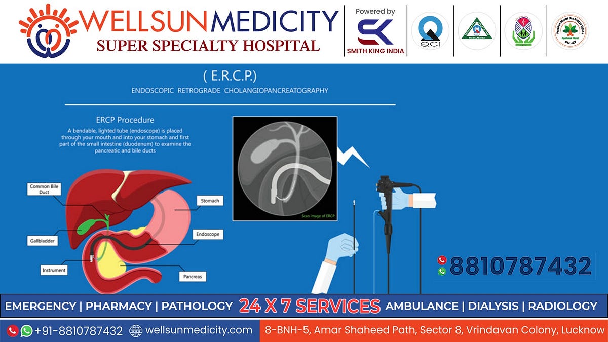 Understanding ERCP A Guide to the Procedure and Its Benefits by Wellsun Medicity