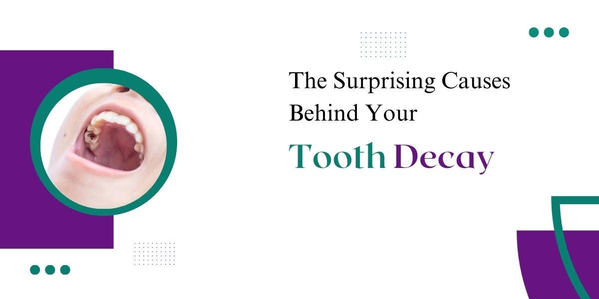 The Surprising Causes Behind Your Tooth Decay SW19 Confidental Dental