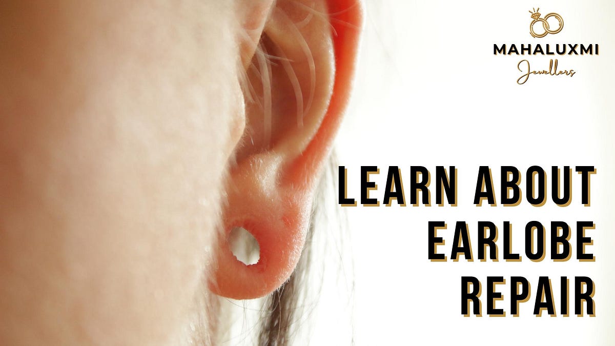 Learn About Earlobe Repair. Elongated ear holes are common, making