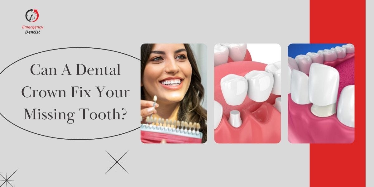 Can A Dental Crown Fix Your Missing Tooth? - Emergency Dentist London