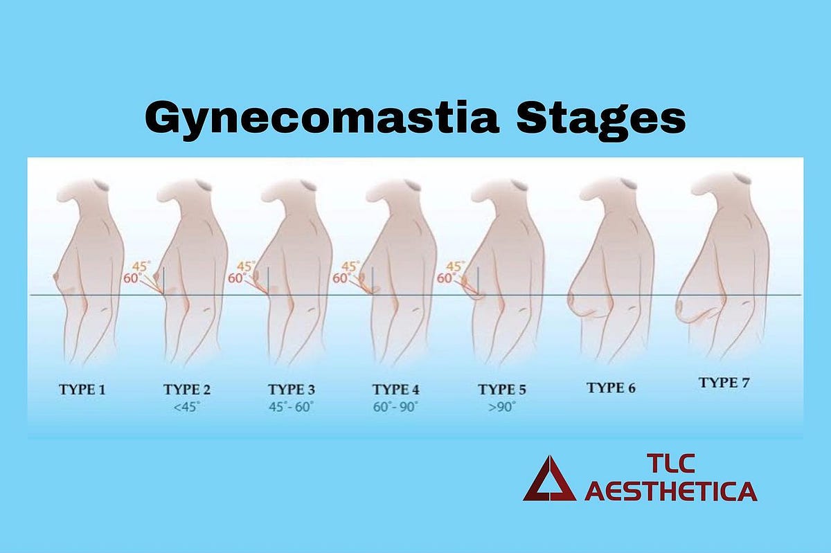 Difference between chest fat and by Tlcaesthetica Medium