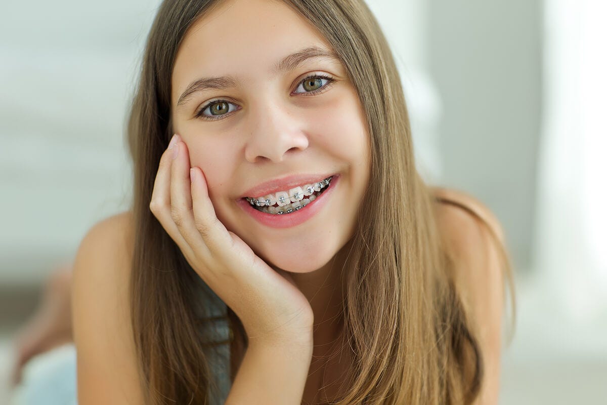 How do braces work? Figsdentalclinicsg Medium