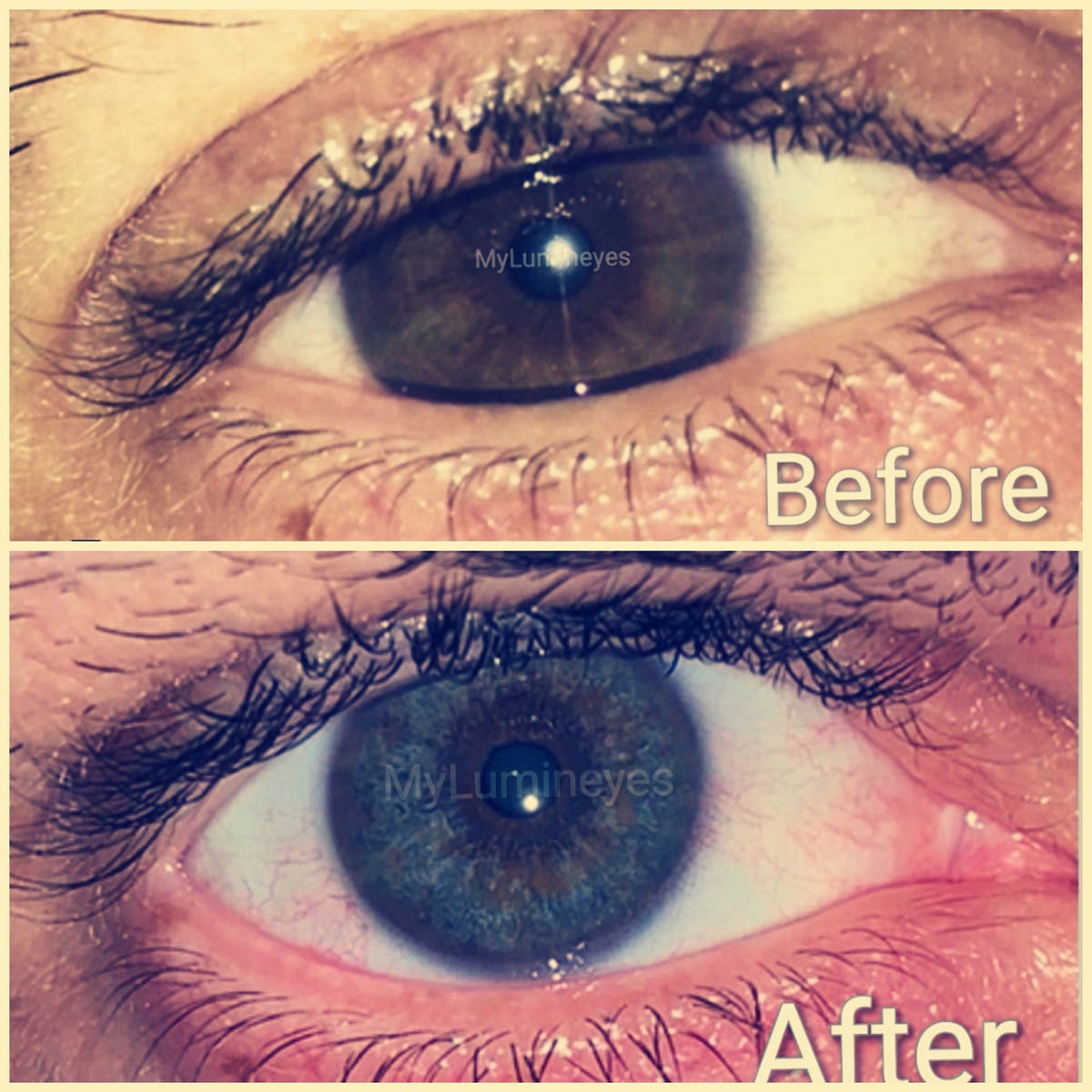 Can you Change Your eye Color safely? by Mylumineyes Medium