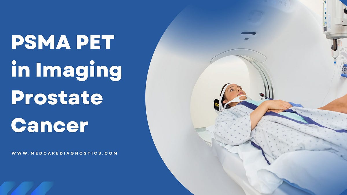 PSMA PET in Imaging Prostate Cancer by Medcare Dignostics Medium
