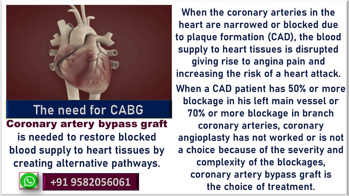 Coronary artery bypass graft (CABG) cost in India. by CMCS Health Your Global Health