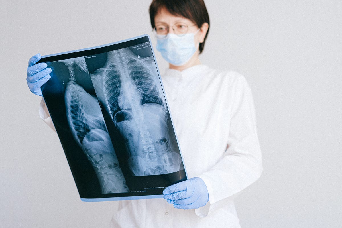 Are X rays Bad for You ?. Let’s start from the basic. What does… by Raveena Anjalee Medium