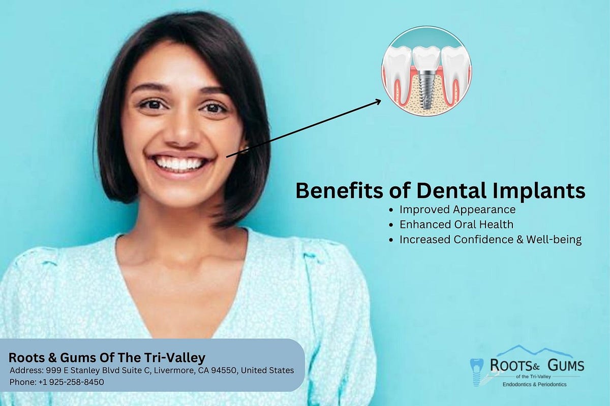 Dental Implants Livermore Steven Williams Medium