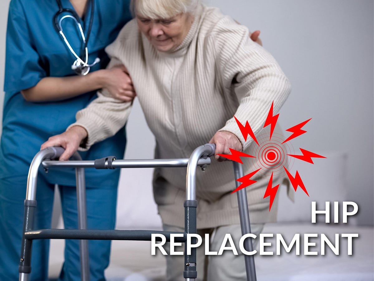 Hip Replacement Surgery. Hip Replacement Surgery Treatment by… by Dr