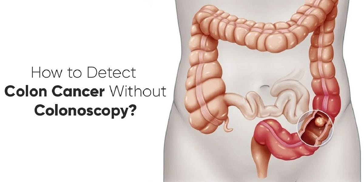 HOW TO DETECT COLON CANCER WITHOUT COLONOSCOPY? Dr. Mark D'Andrea