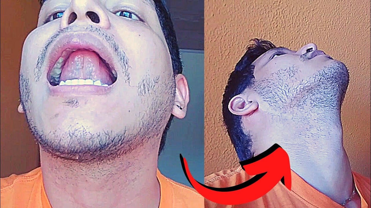 Mewing and Speech: Can Proper Tongue Posture Impact Vocal Clarity? | by