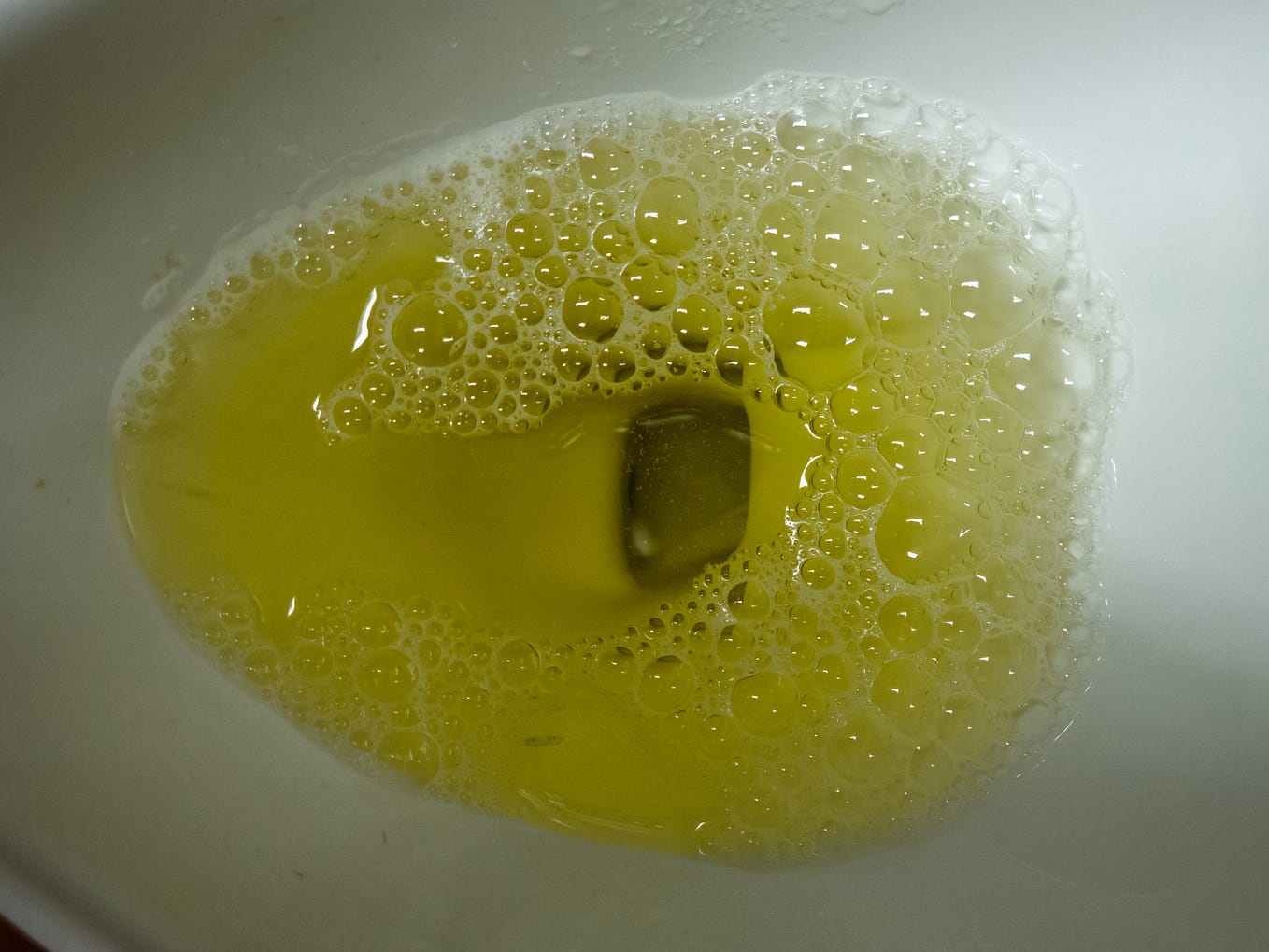 Foamy Urine Vs Normal Urine What is the Difference by Health Educare