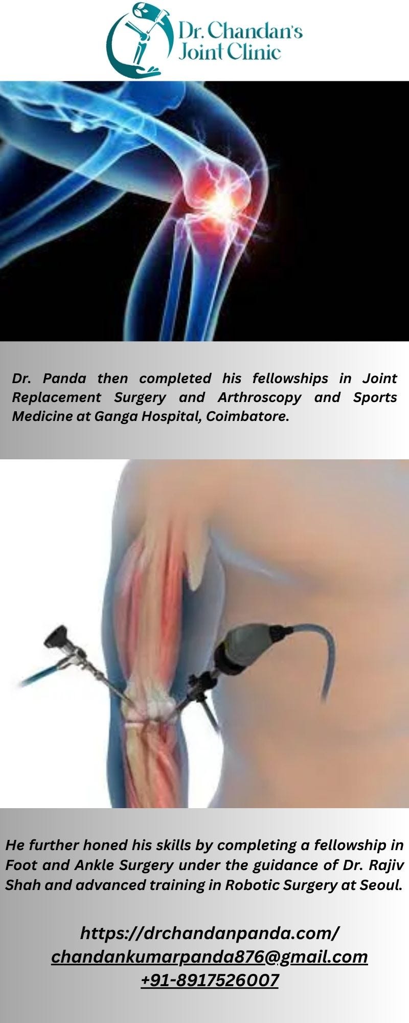 Best Arthroscopic ligament Surgeon Drpandachandan Medium