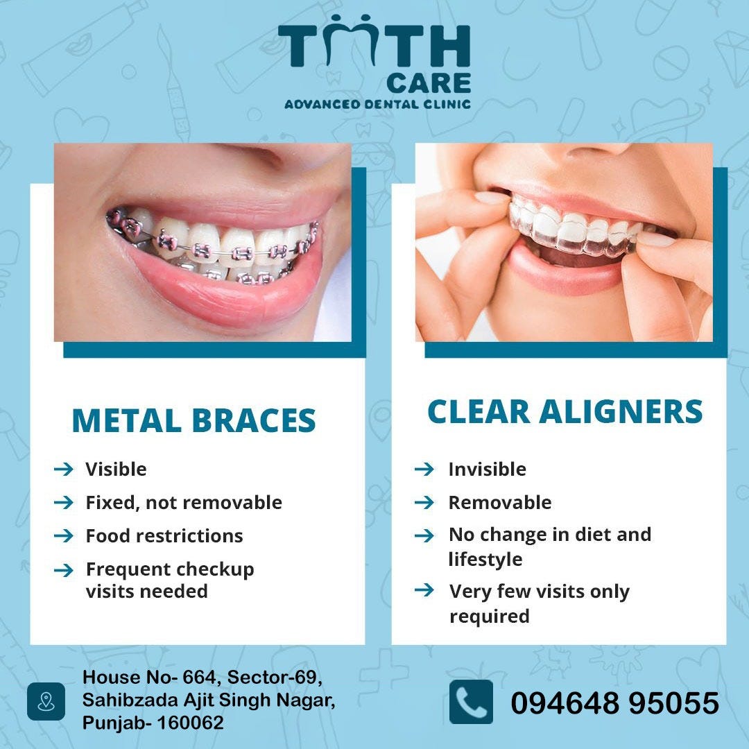 Teeth aligners in mohali Toothcaredentalclinic Medium