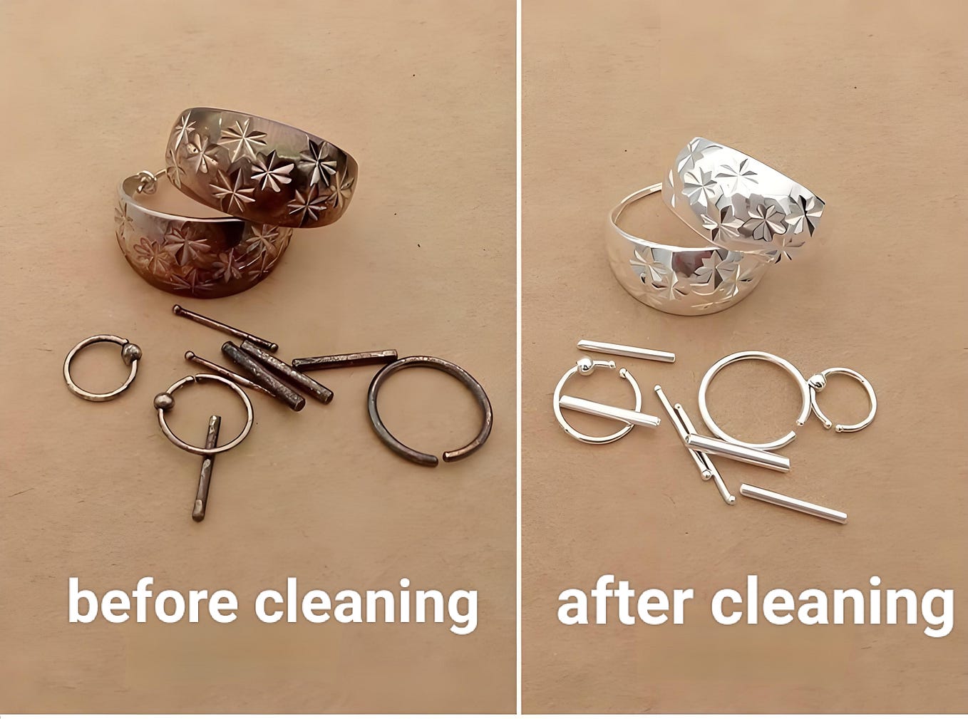 Finger Ring Stuck on a Swollen Finger? Here’s How to Remove It by