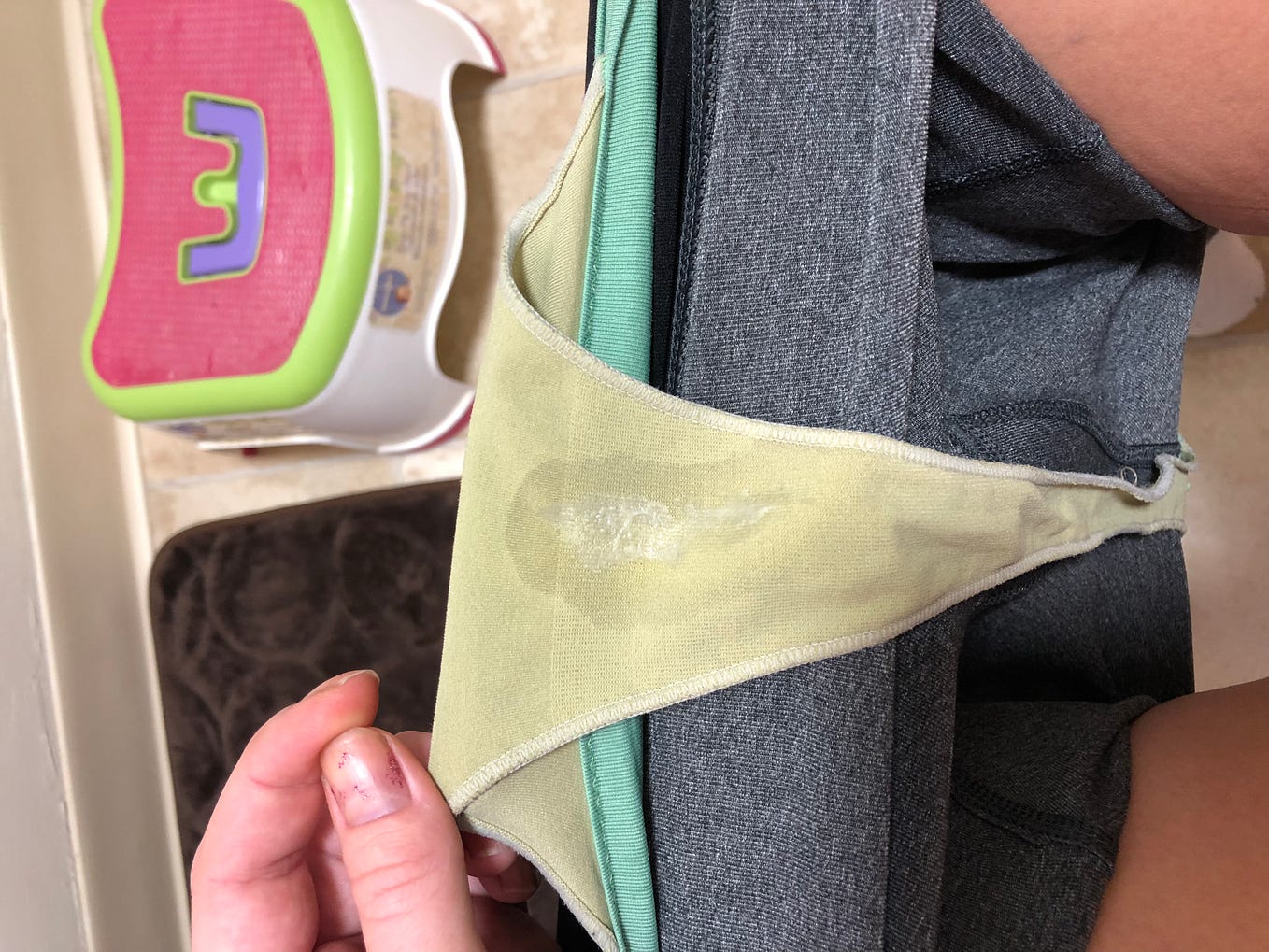 Can a Yeast Infection Cause Jock Itch? Medium