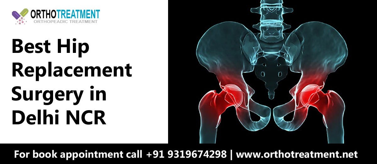 Best Hip Replacement surgeon in Delhi NCR by Ortho Treatment Medium