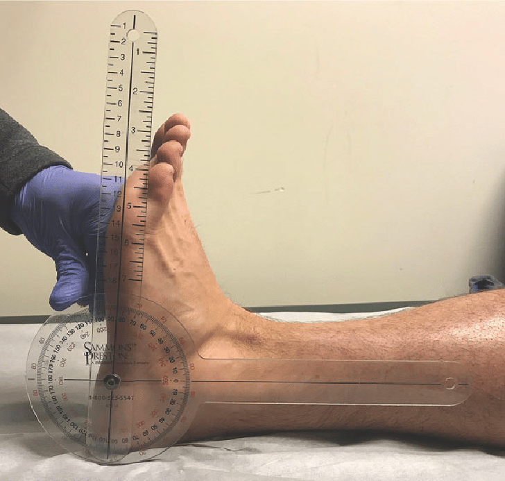 Range of Motion Ankle Dorsiflexion, ankle dorsiflexion mipro.co.uk