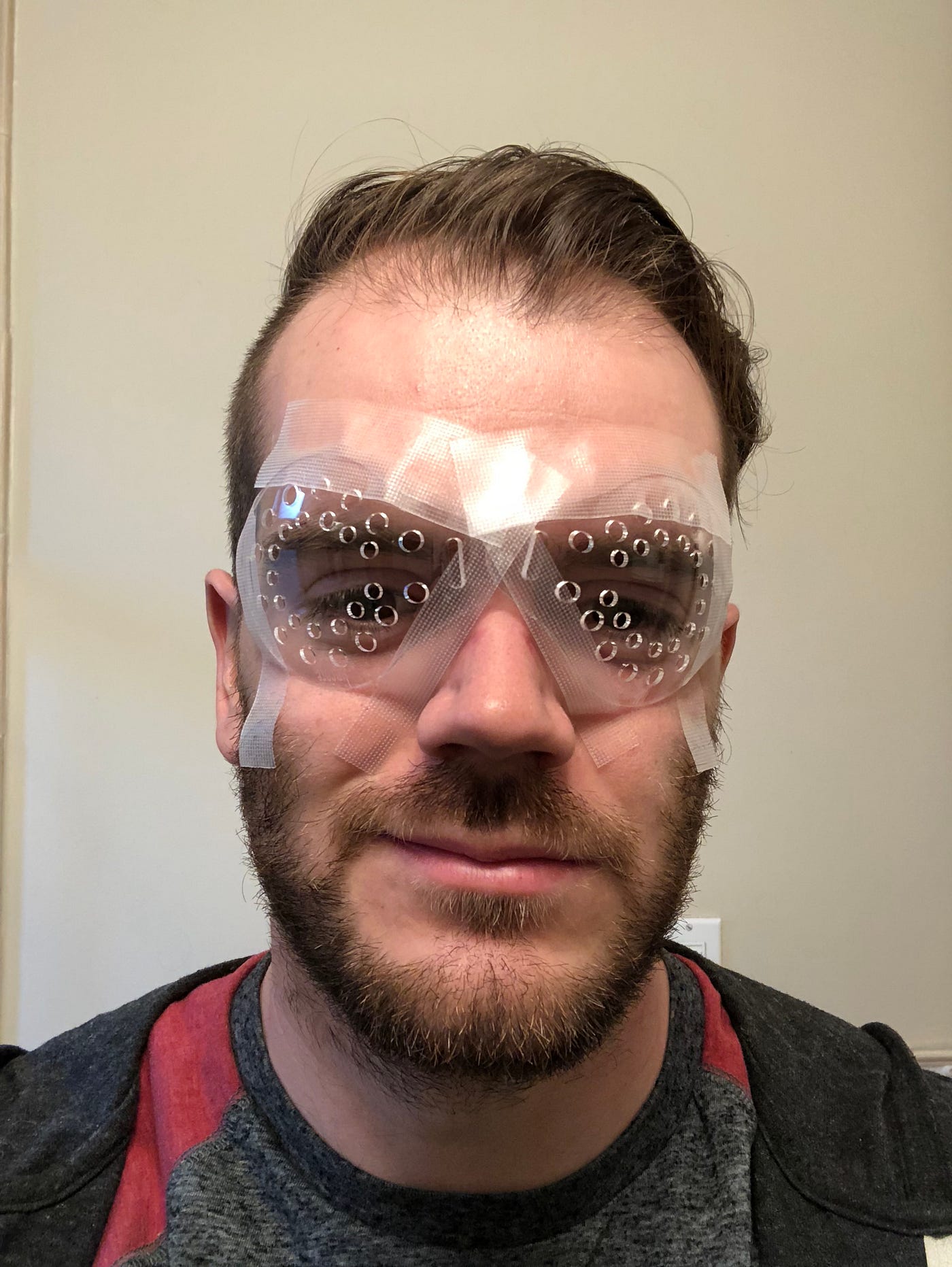 Lasik Before And After
