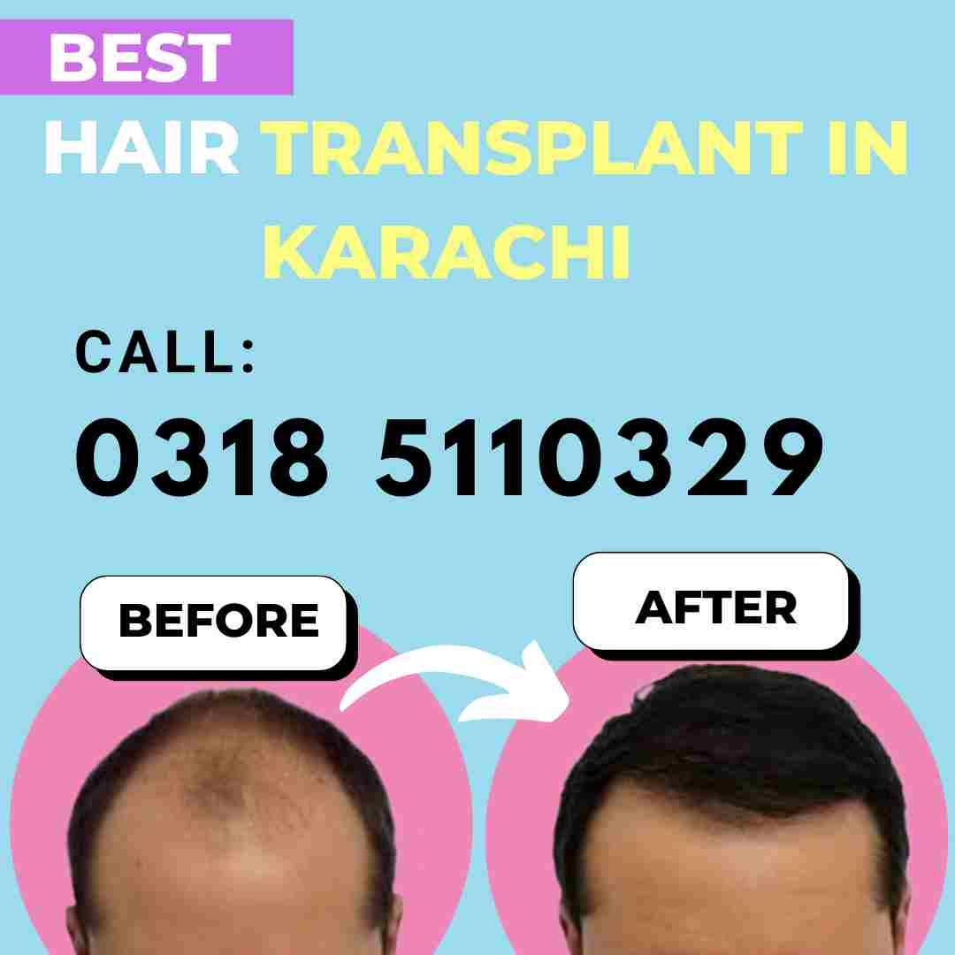 Hair Treatment in Karachi Medium