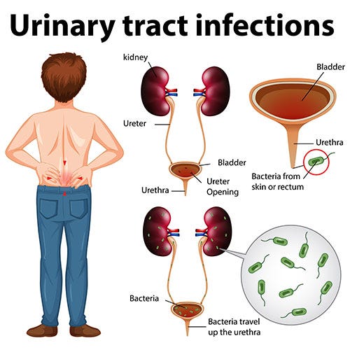 Can you explain the typical symptoms of a urinary tract infection (UTI