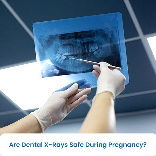 Are Dental XRays Safe During Pregnancy by Premier Periodontics and