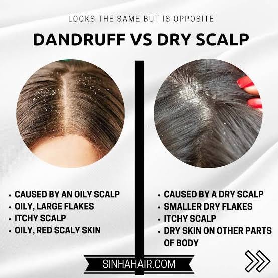 CONFUSED Dandruff or Dry scalp. I’m sure that a lot of us have gone to