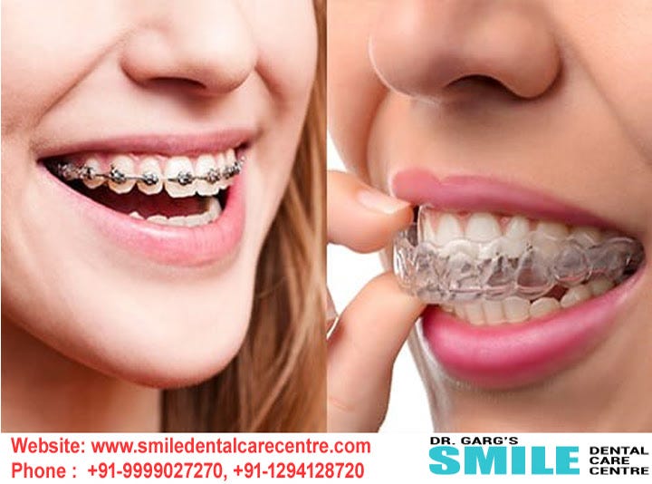 Orthodontic Dental Clinic Offers What Kinds Of Treatment? by