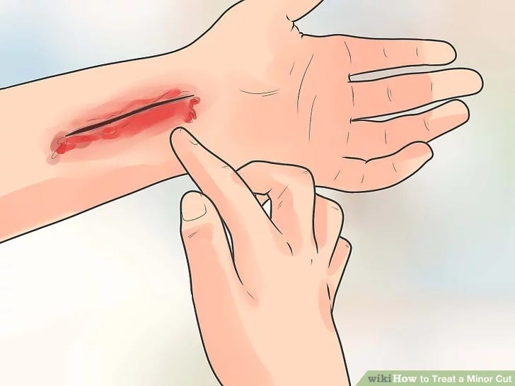 Super Glue for Cuts The Unexpected Wound Care Hero You Need to Know