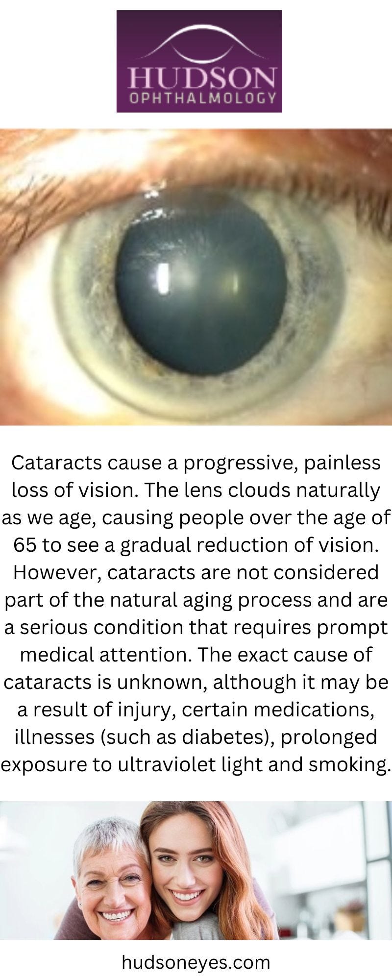 Laser Surgery for Eye Pressure Hudsoneyes Medium