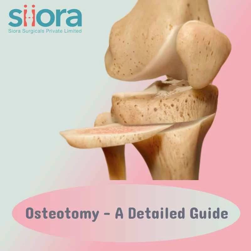 Osteotomy — A Detailed Guide Siiora Surgical Medium