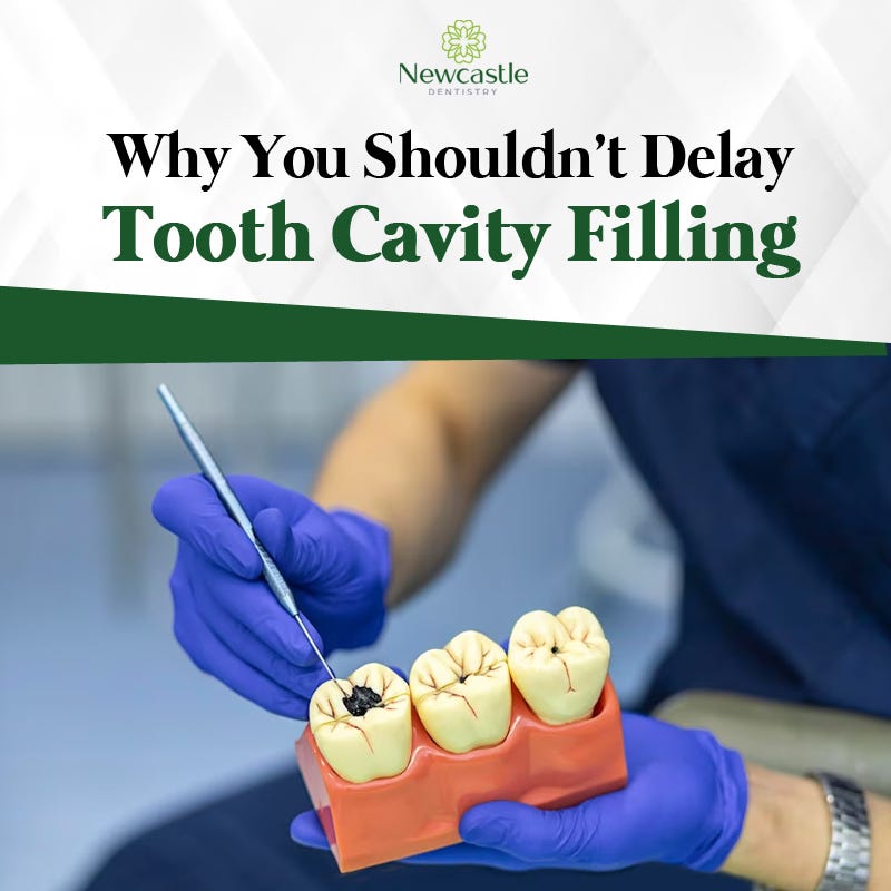 Importance of Timely Tooth Cavity Filling Why You Shouldn’t Delay by