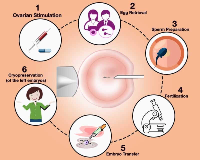 What is ICSI A Detailed Guide to Intracytoplasmic Sperm Injection by Bestivf clinic Medium