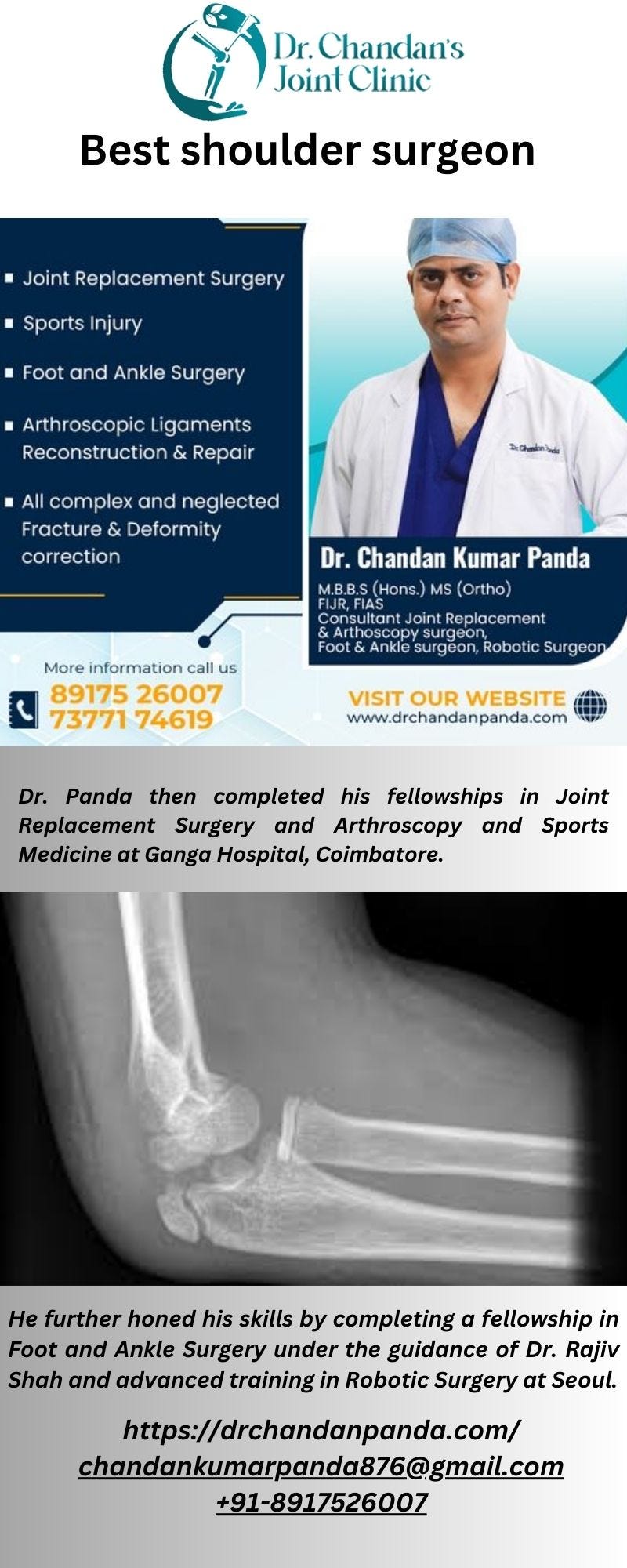 Shoulder Redemption Unleashing the Power of the best Shoulder Surgeon