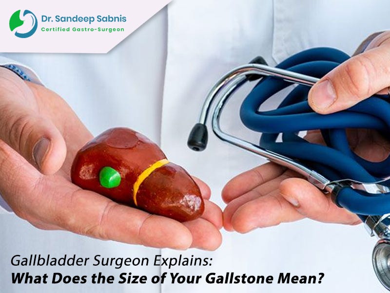 Gallbladder Surgeon Explains What Does the Size of Your Gallstone Mean