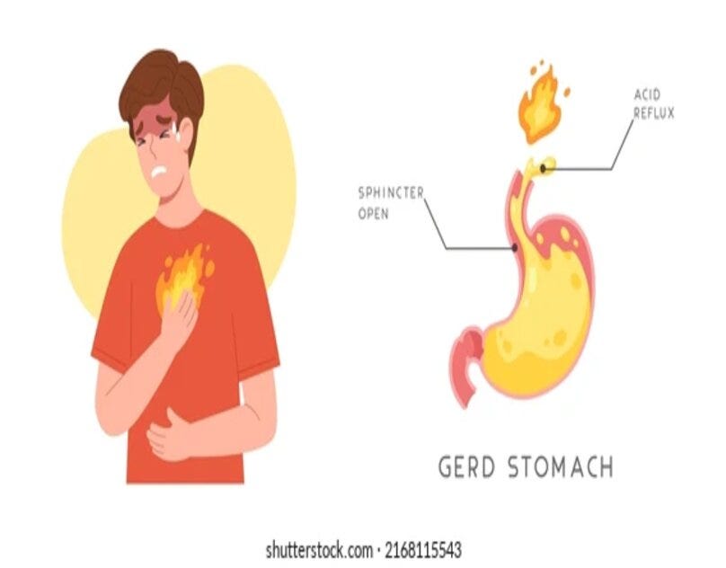 Navigating GERD Treatment in Mumbai Insights from Dr. Deepam Shah at