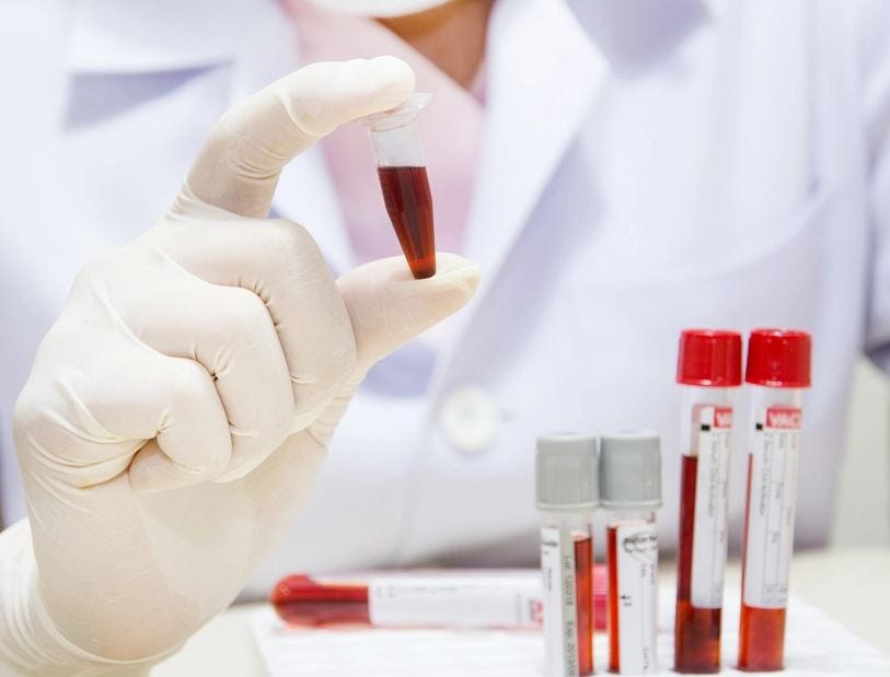 A Comprehensive Guide to Full Body Checkup, Blood Test, Health Checkup