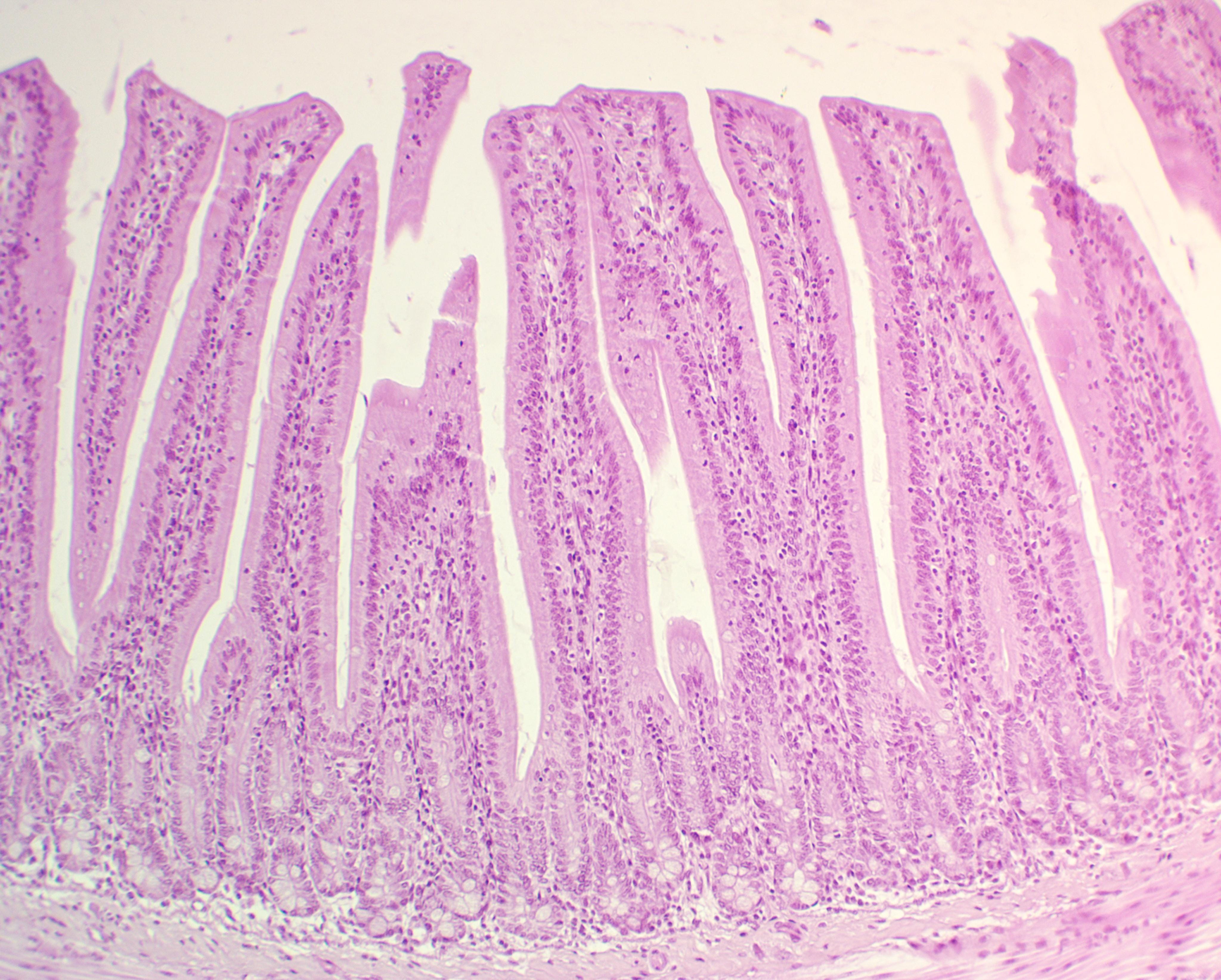 Simple Columnar Epithelium Microvilli