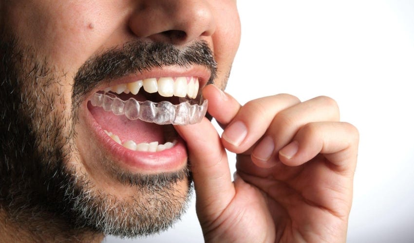 What to do if your Invisalign Aligner is Cutting Your Gums? by Dental