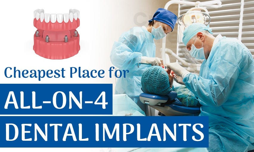Why India has Emerged as the Cheapest Country for Allon4 Dental