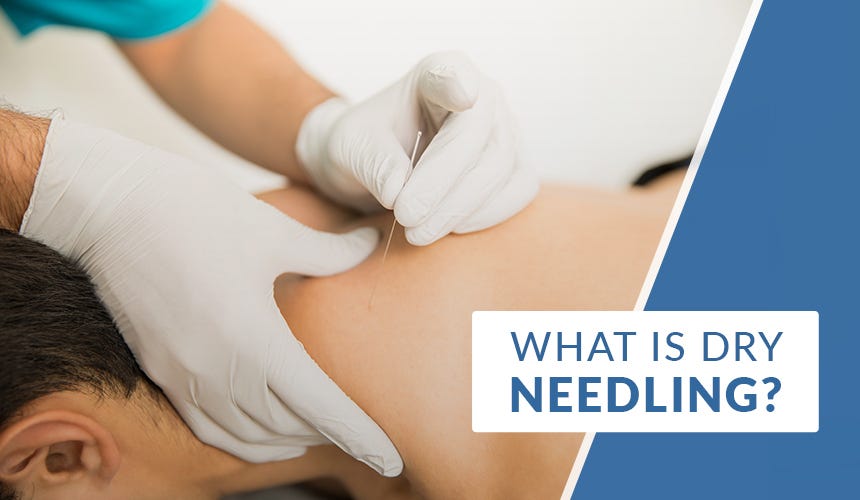 What’s Dry Needling & Can it help Me? by Orleans Physiotherapy Medium