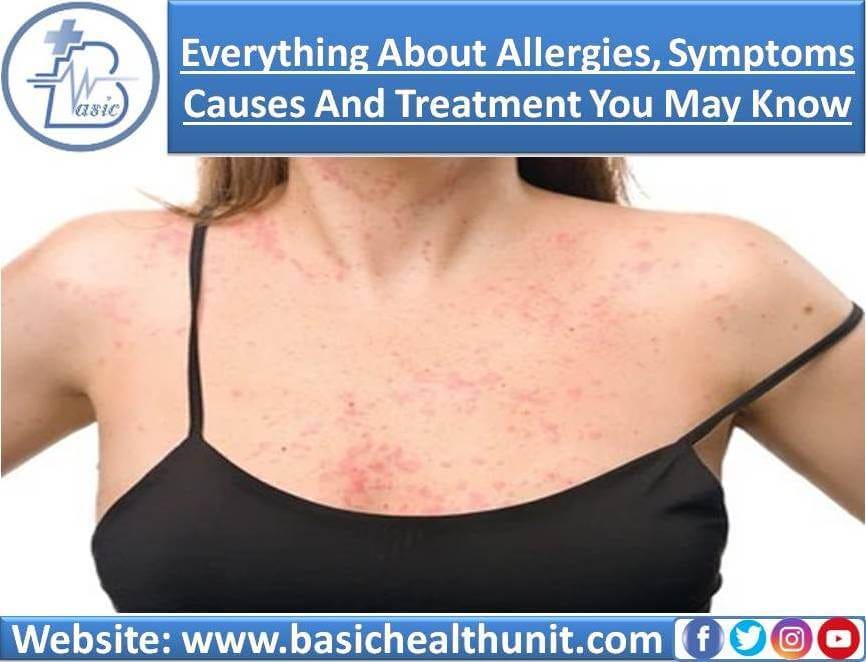 Everything About Allergies, Symptoms and Causes You Need To Know (What
