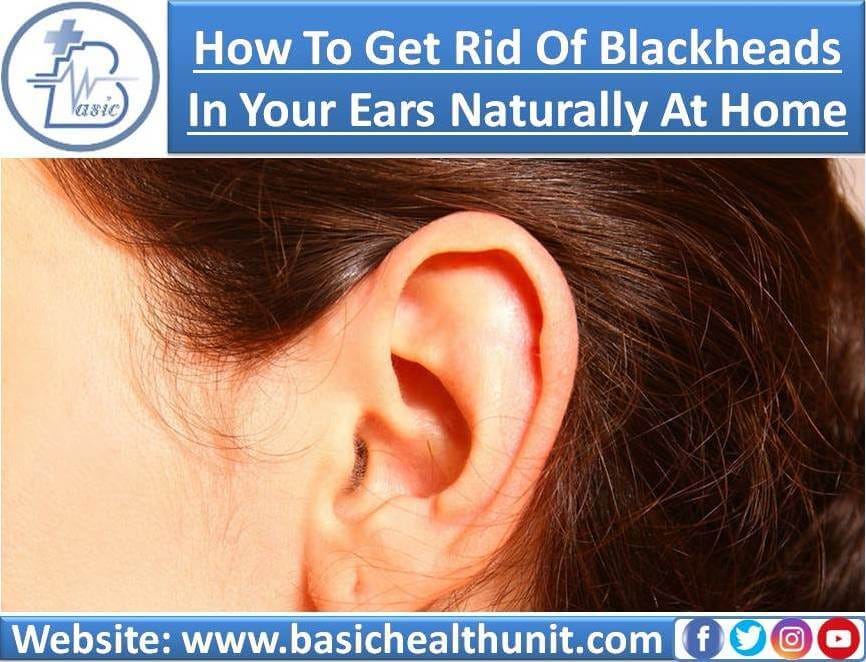 How To Get Rid Of Blackheads In Ears Naturally At Home by Muhammad