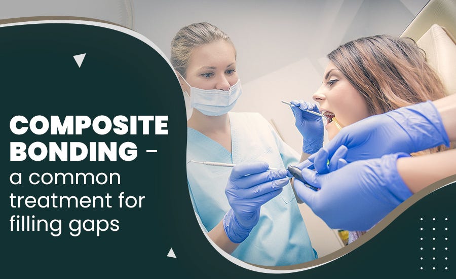Composite Bonding — a Common Treatment for Filling Gaps by