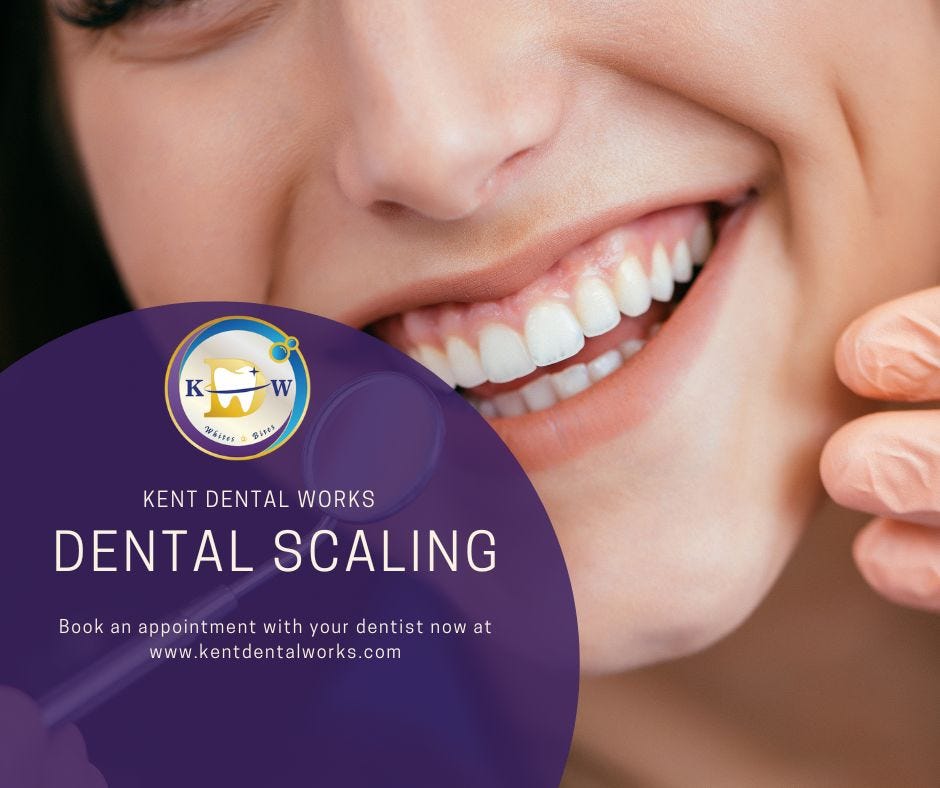 Dental Scaling and Polishing (Teeth Cleaning) in Singapore Kent