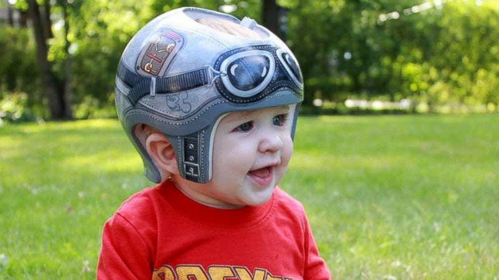 Plagiocephaly Treatment & Plagiocephaly Helmet by David James Medium