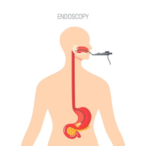 Gastroscopy and colonoscopy key procedures to early detect gastric