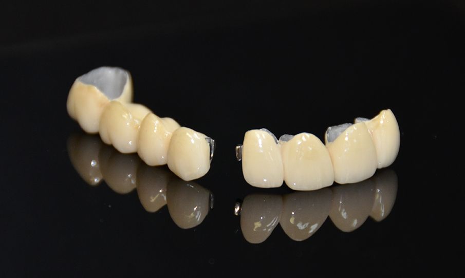 M.D.S Crowns & Bridges