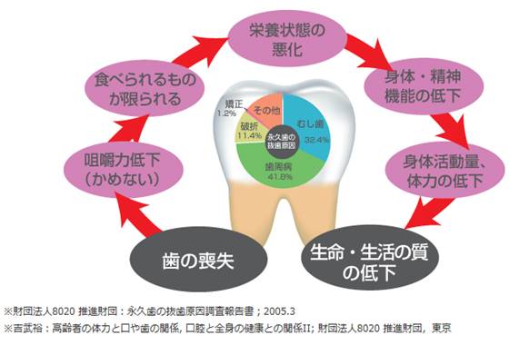 知られざる歯を失うことによる身体への影響 三隅歯科クリニック 熊本県熊本市東区長嶺南