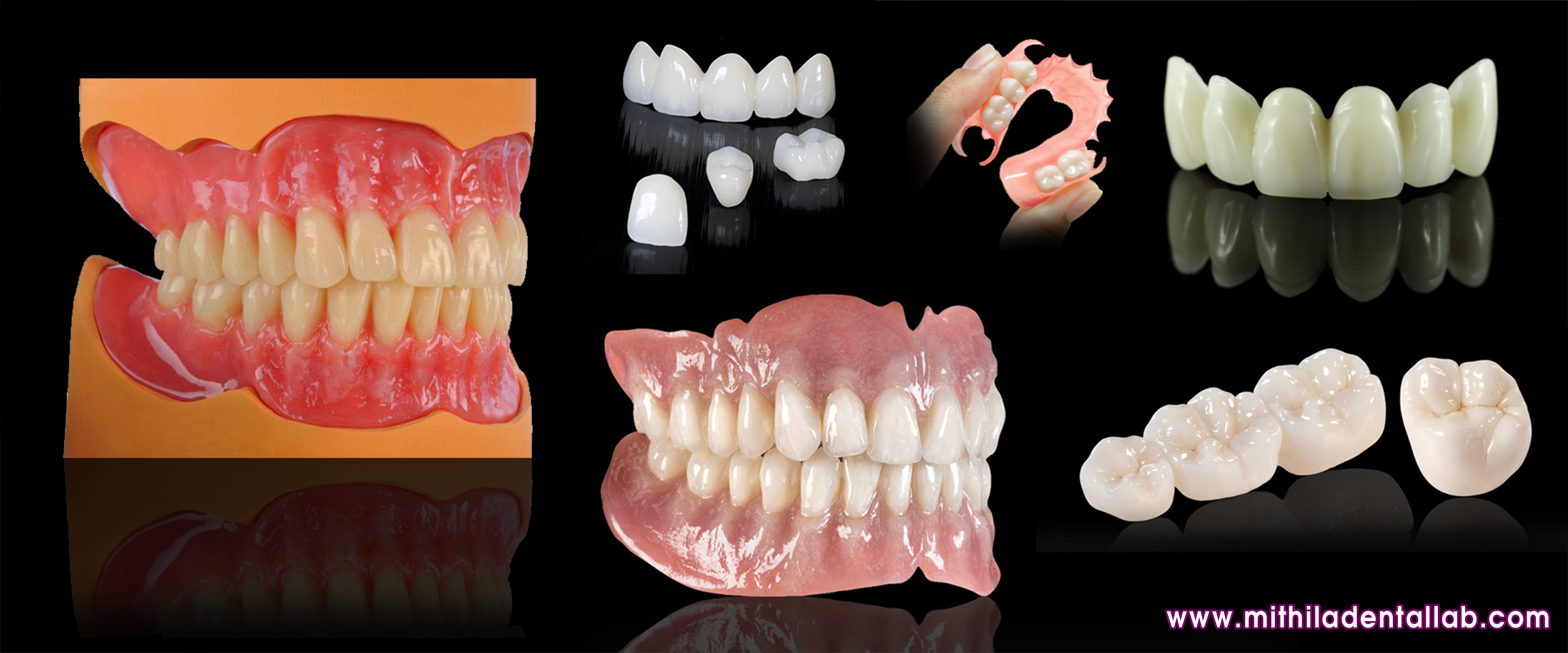 zirconia crown teeth denture, mdssuperunbreakabledenture, frs