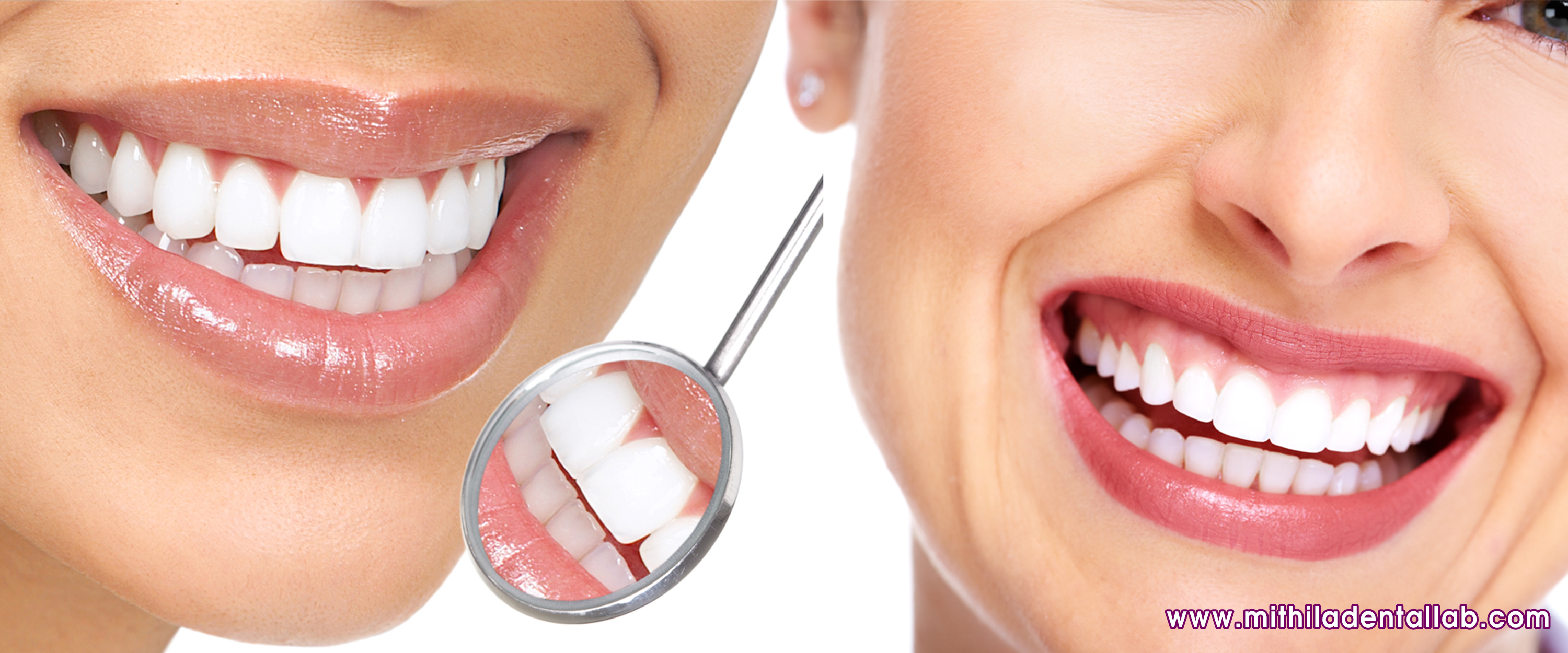 zirconia crown teeth denture, mdssuperunbreakabledenture, frs